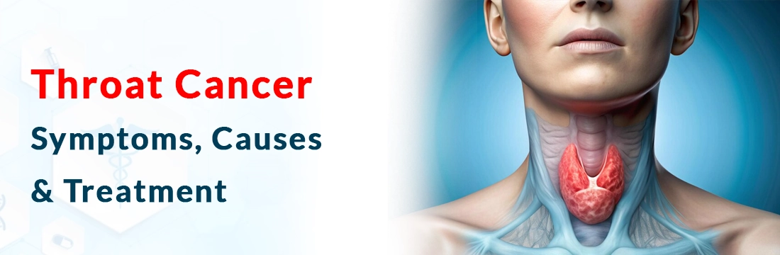 Throat Cancer: Symptoms, Causes & Treatment